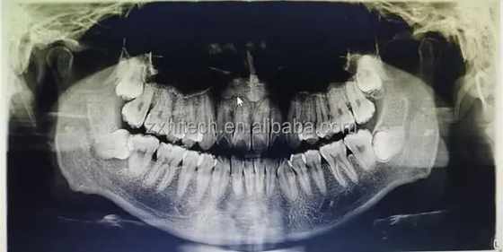 Dental CT Scanning Instruments of ZX Company
